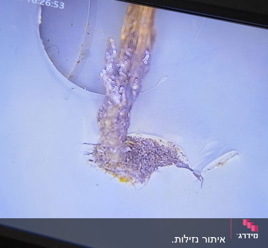 צילום פנים צנרת באמצעות סיב אופטי המציג חסימה בצינור